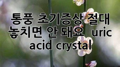 🚨 통풍 초기증상? 절대 놓치면 안 돼요!  uric acid crystal 💥